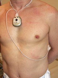 En mans bara överkropp med en liten apparat runt halsen vars sladd hänger ner till en elektrod på sidan av bröstkorgen.